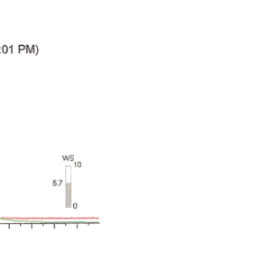 ORA של קראטוקונוס